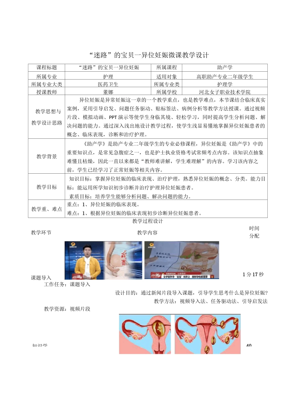 异位妊娠教学设计_第2页
