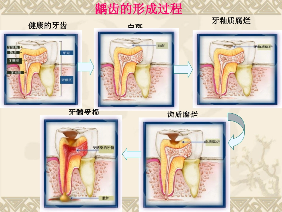 保护牙齿课件_第2页