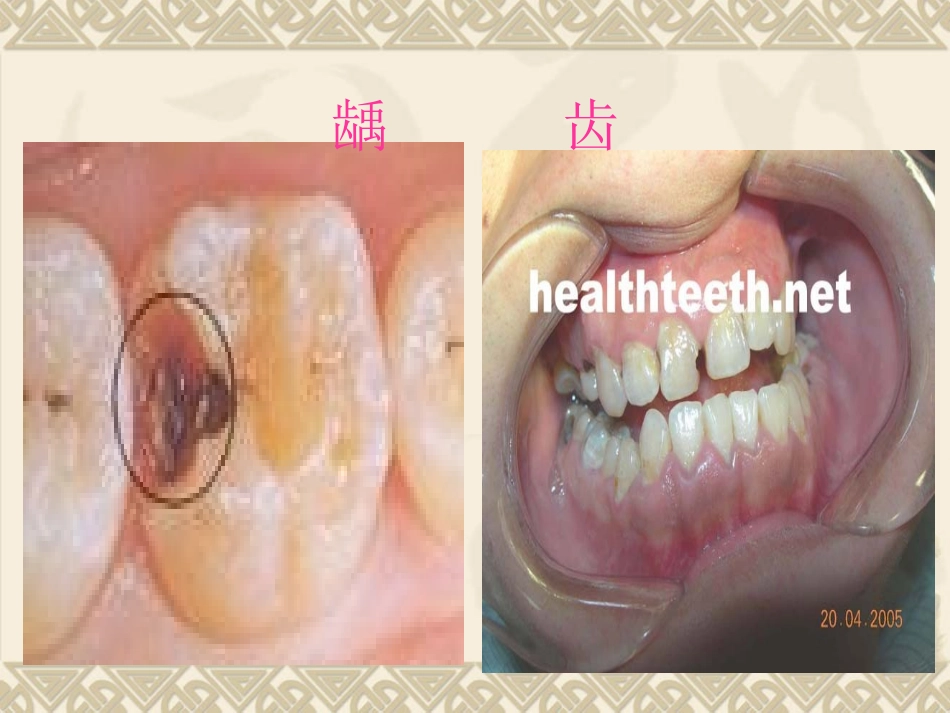 保护牙齿课件_第3页