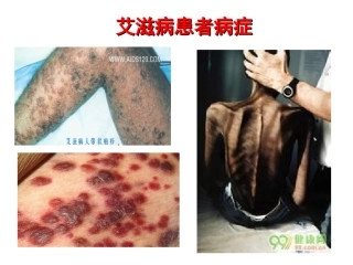 -免疫调节(届上课用）