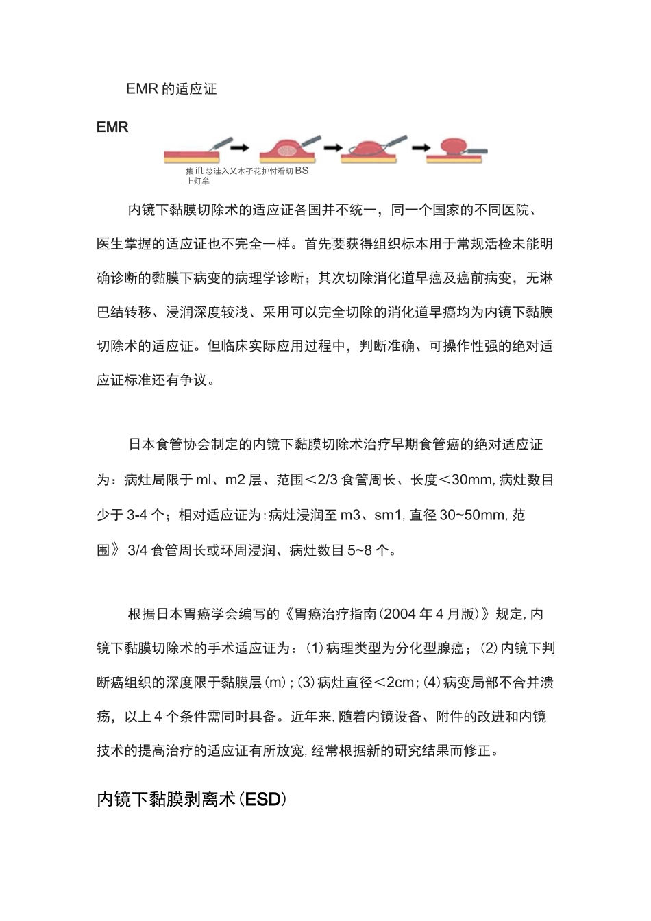 内镜下治疗肠息肉技术(EMR ESD APC等)_第2页