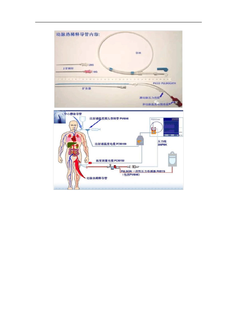 PICCO操作规程 _第2页