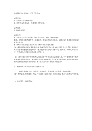 安全教案：受伤了怎么办