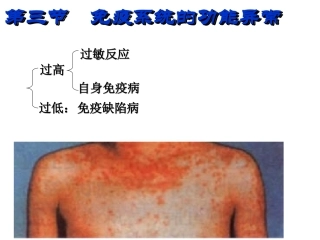 免疫系统的功能异常