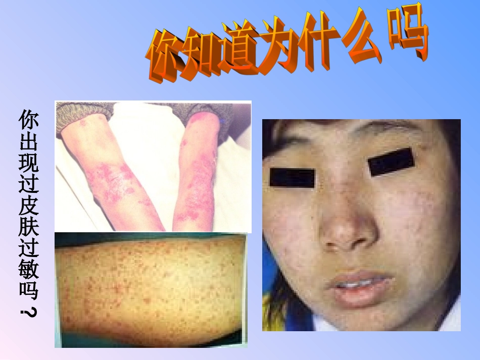 第二节免疫与计划免疫_第2页