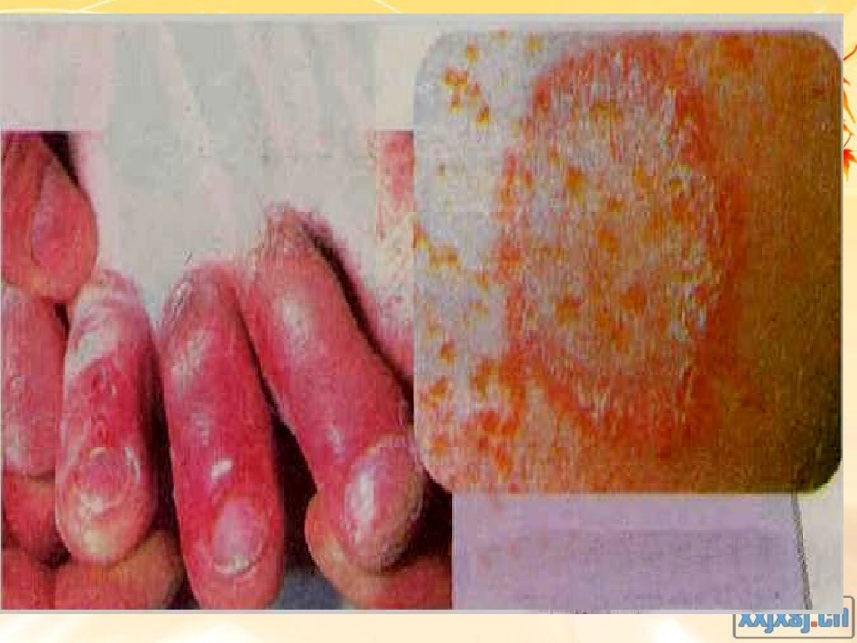 八年级生物人类对细菌和真菌的利用_第3页