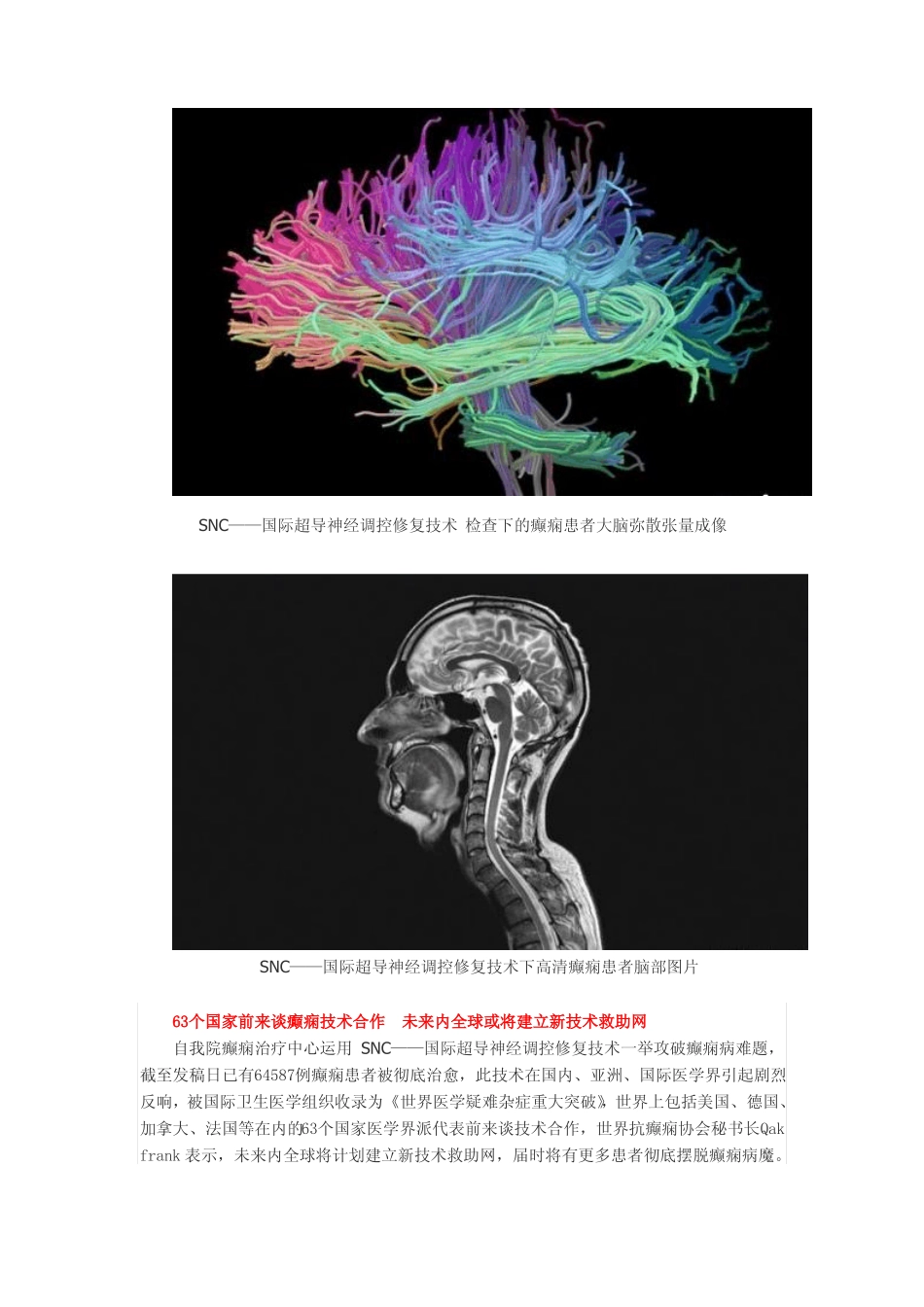 SNRC——国际超导神经调控修复技术_第2页