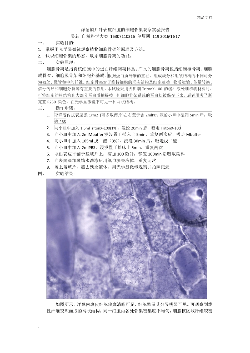 洋葱鳞片叶表皮细胞的细胞骨架观察试验报告_第1页