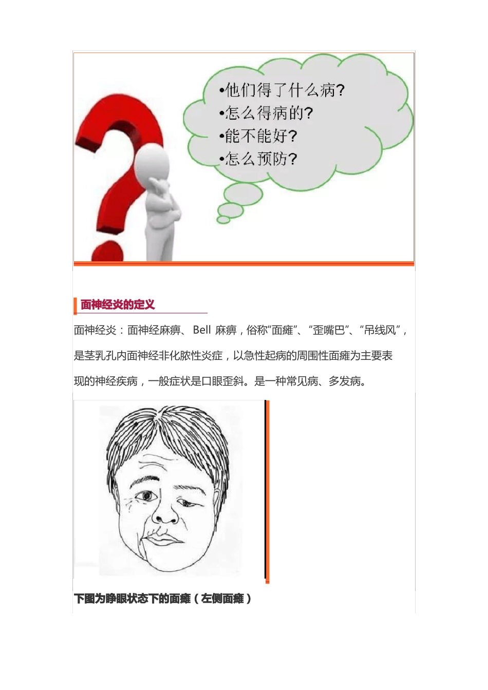 面神经麻痹宣教_第3页