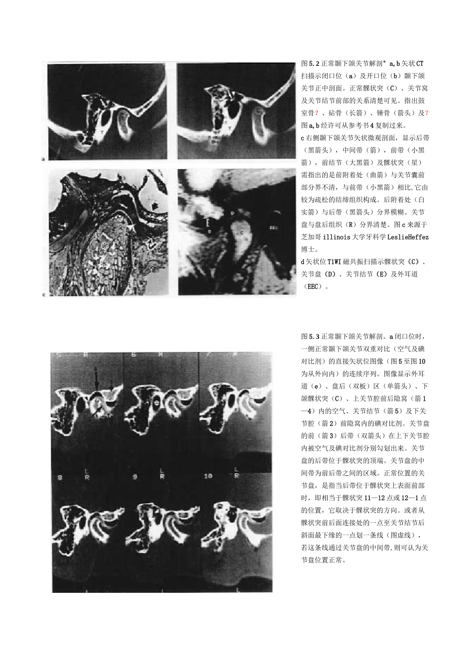 颞下颌关节讲解_第3页