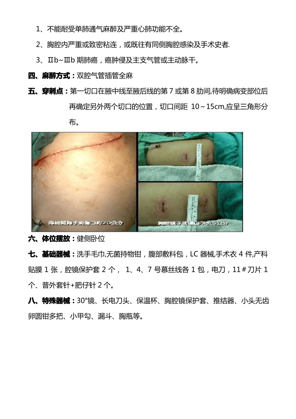 胸腔镜手术配合指引_第3页