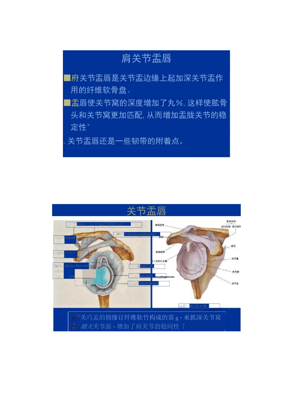 肩关节盂唇损伤的MRI诊断讲解_第2页
