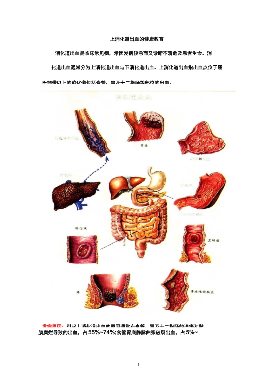 上消化道出血健康教育_第1页