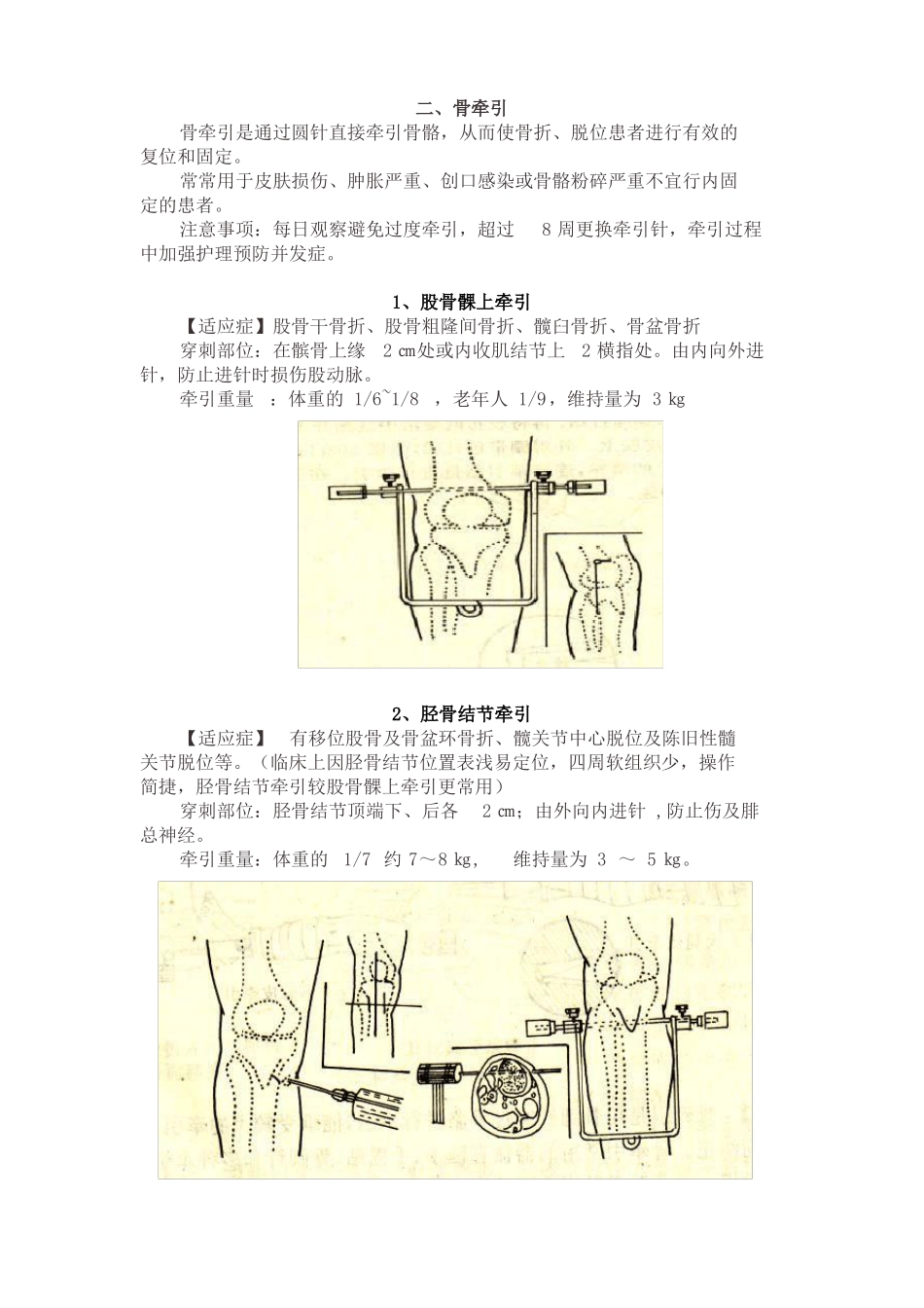 骨科牵引术常用方式及要点详解_第2页