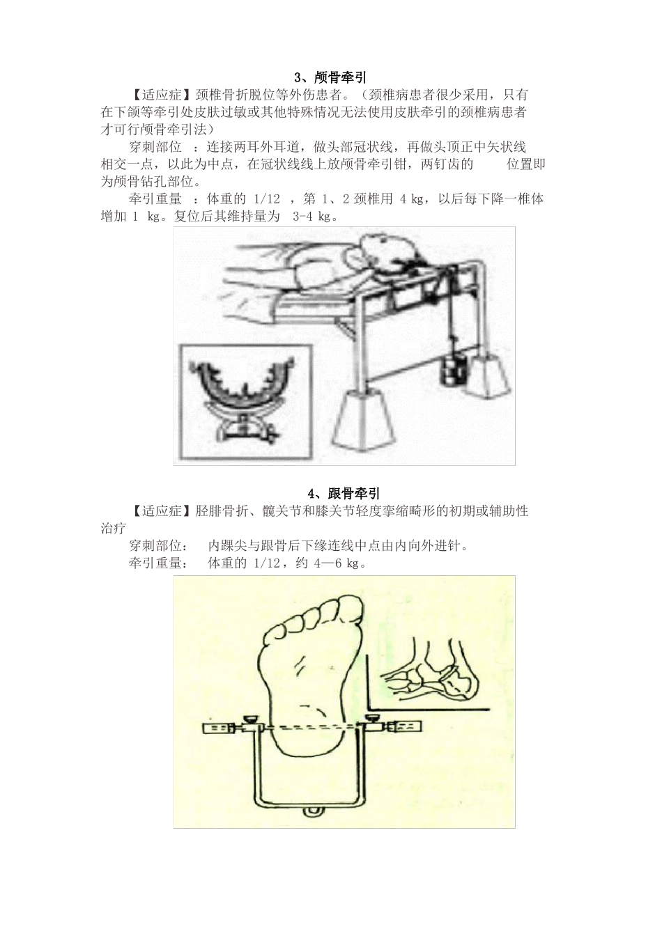 骨科牵引术常用方式及要点详解_第3页