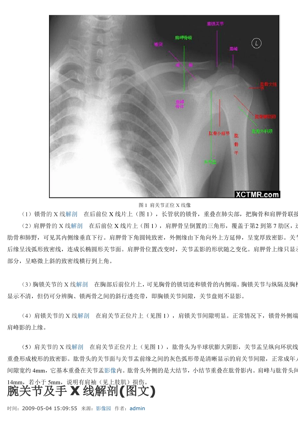 骨科X线解剖四肢、关节讲解_第3页