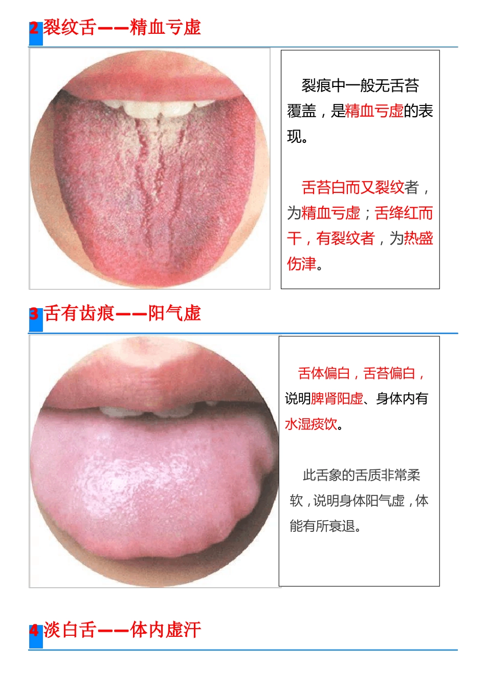 高清舌诊图谱_第2页