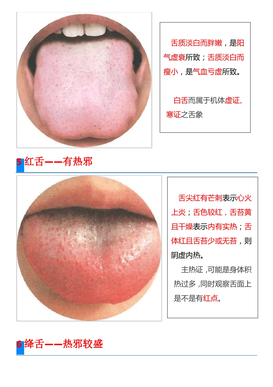 高清舌诊图谱_第3页