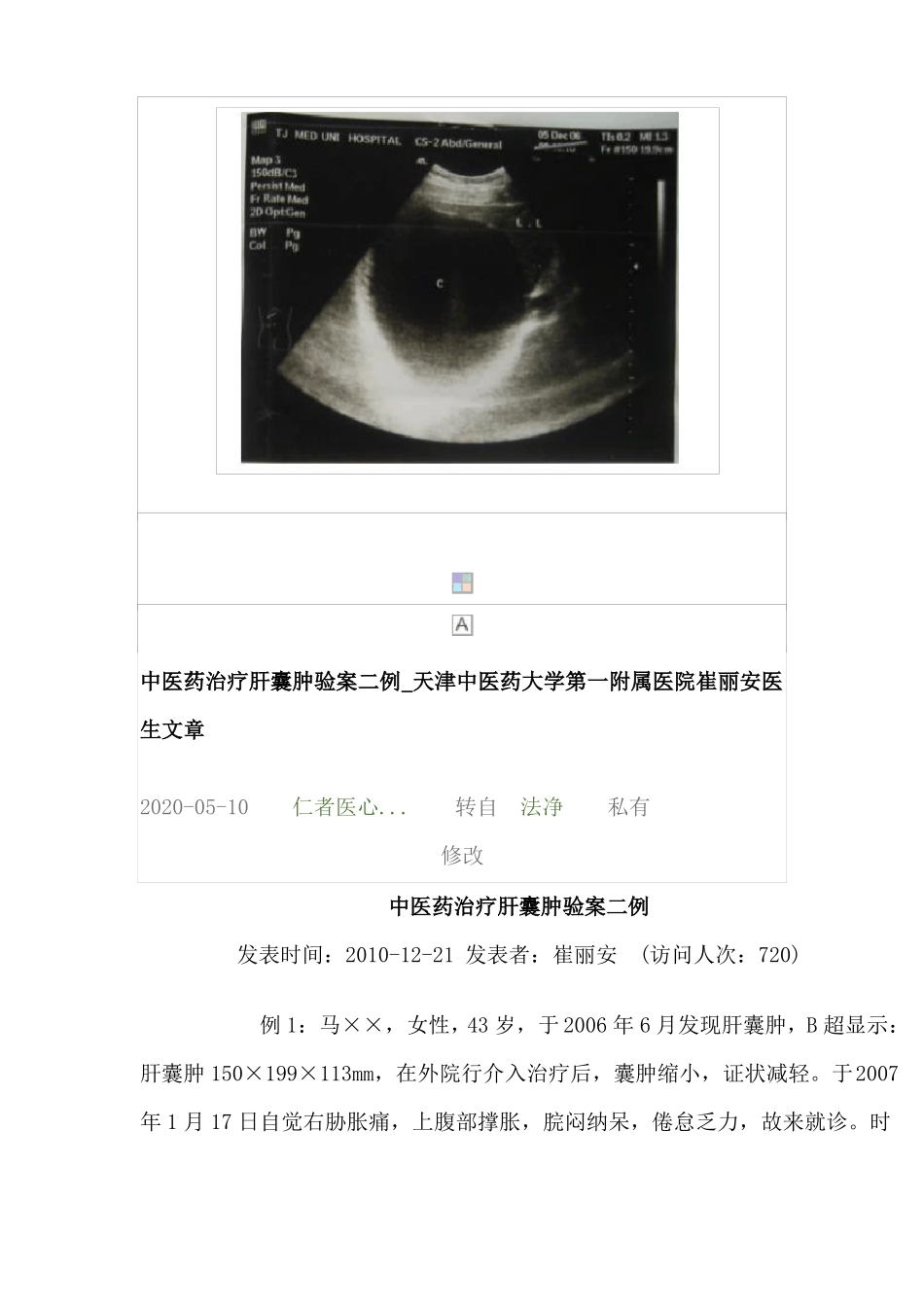 中医药治疗肝囊肿医案_第2页