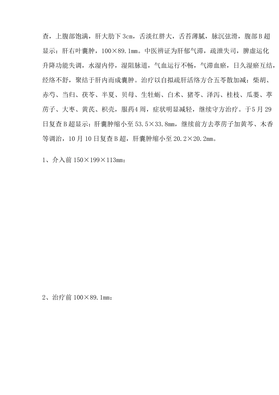 中医药治疗肝囊肿医案_第3页