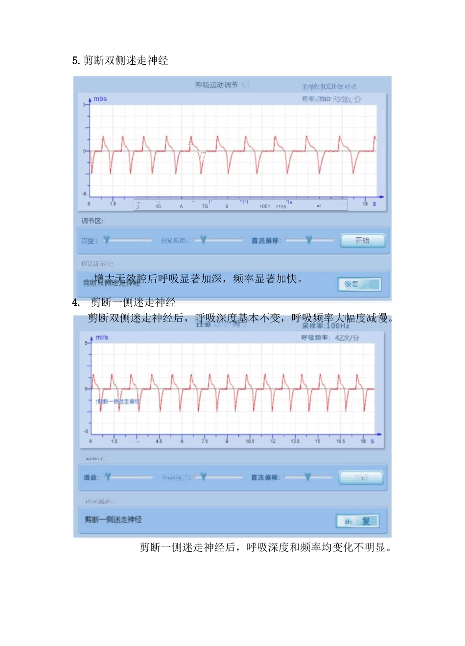 家兔呼吸运动的调节实验报告_第3页