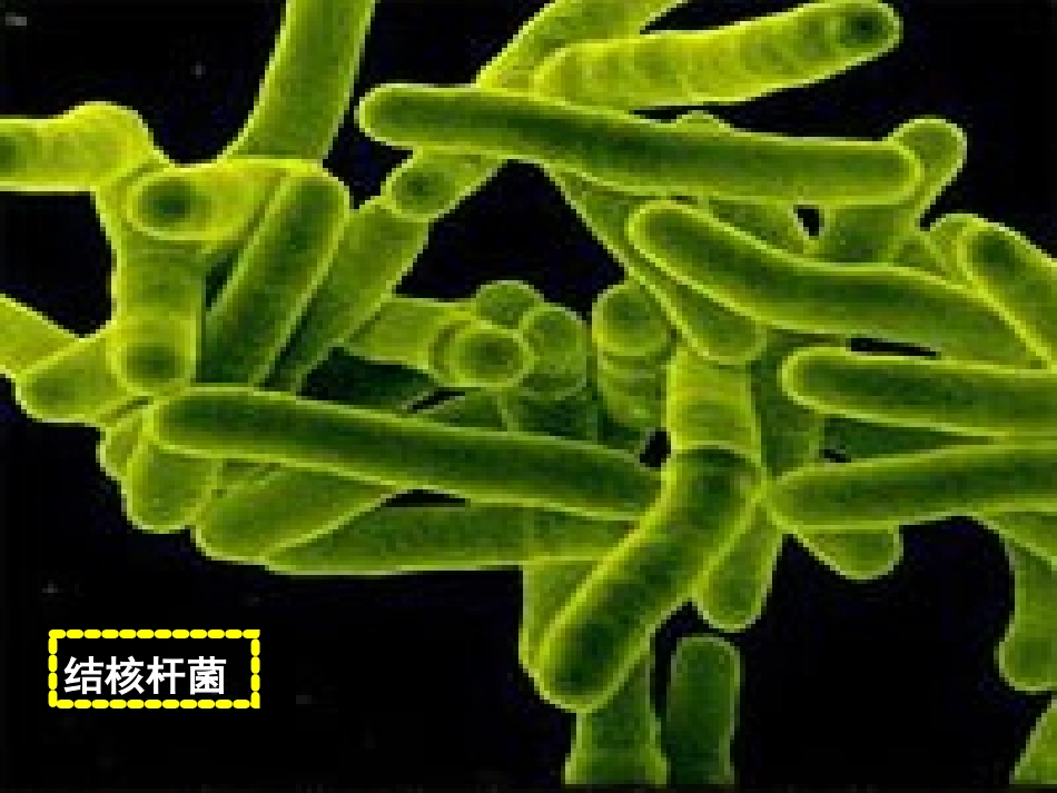 结核病防治知识课件_第3页