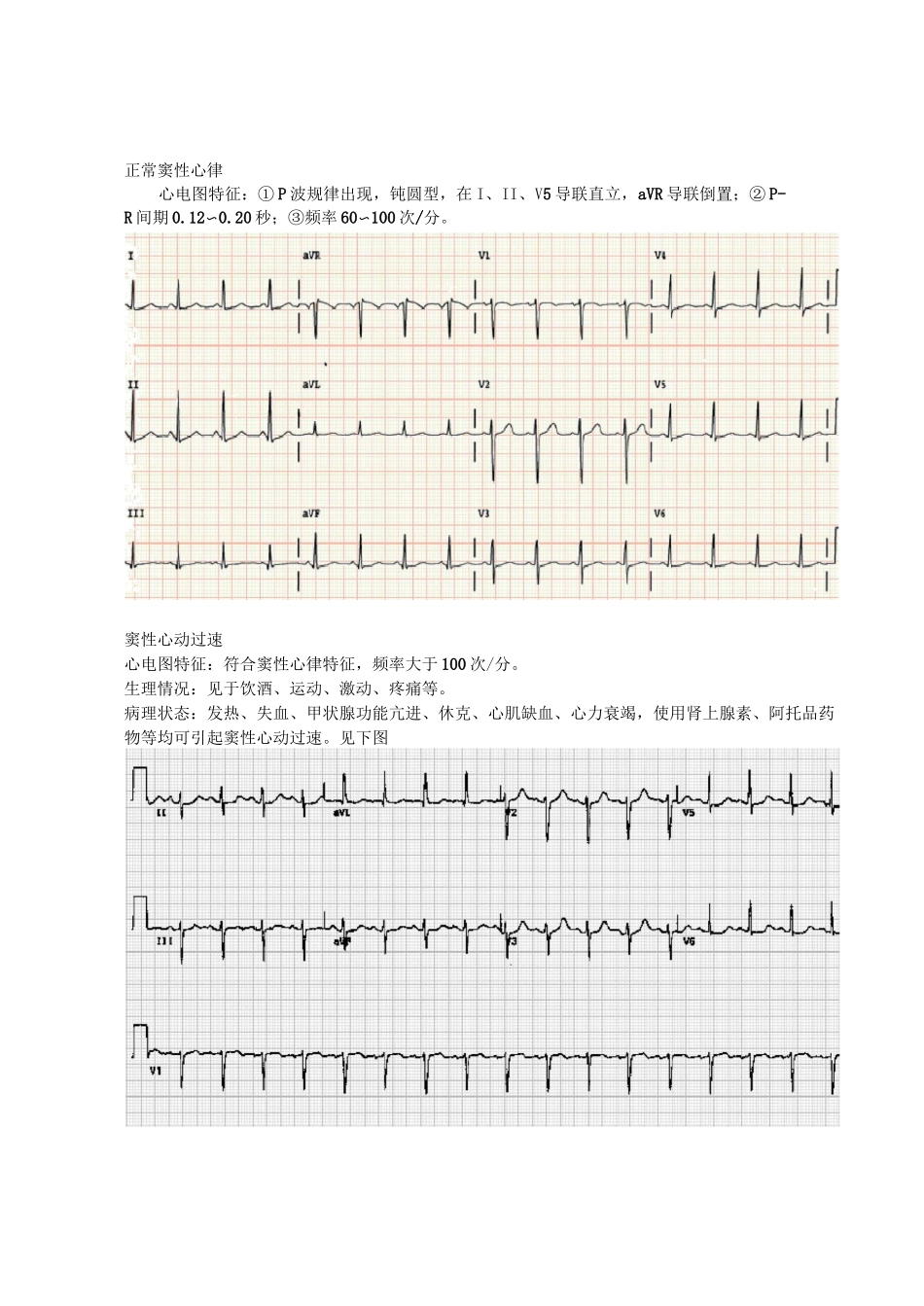 异常心电图识别_第1页