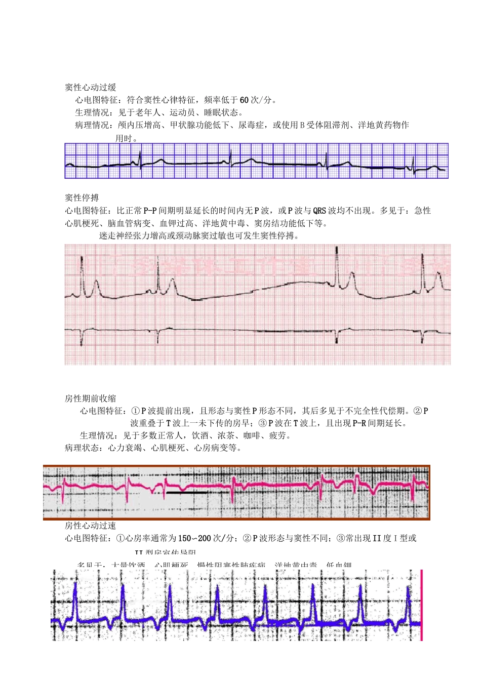 异常心电图识别_第2页