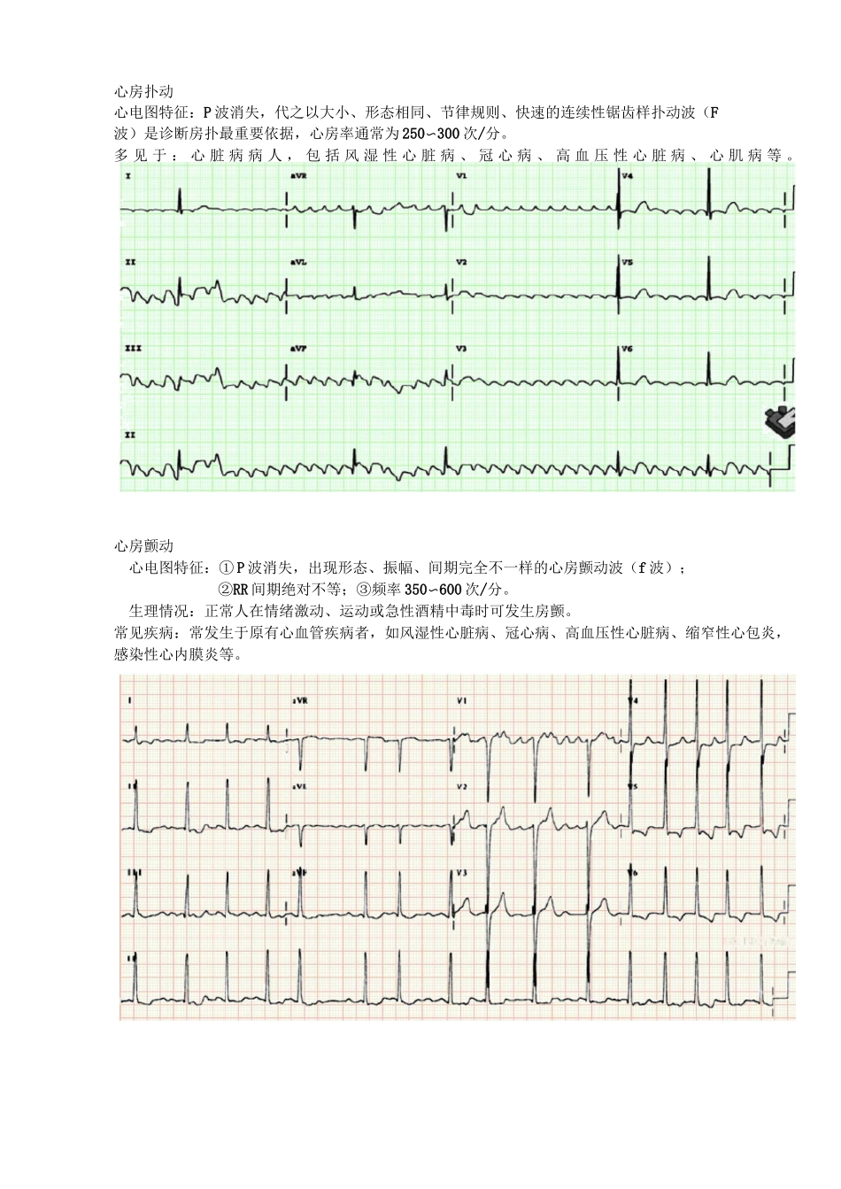 异常心电图识别_第3页