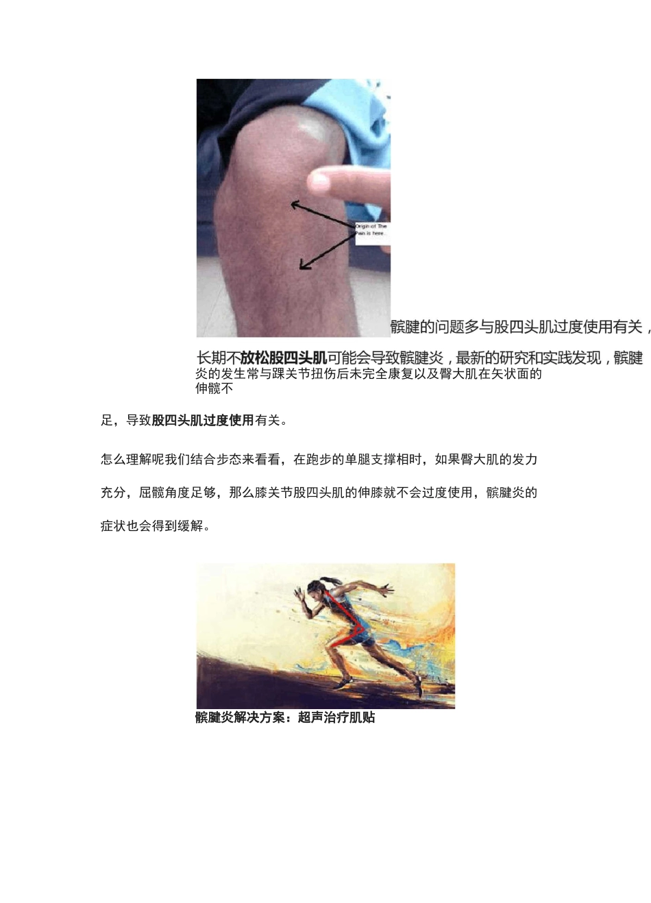 跑步膝盖痛(下)_第2页