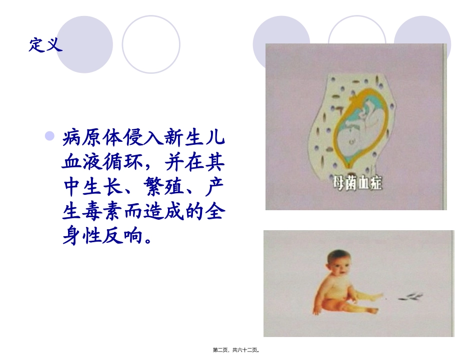 4章3节新生儿败血症 医学教学课件_第2页
