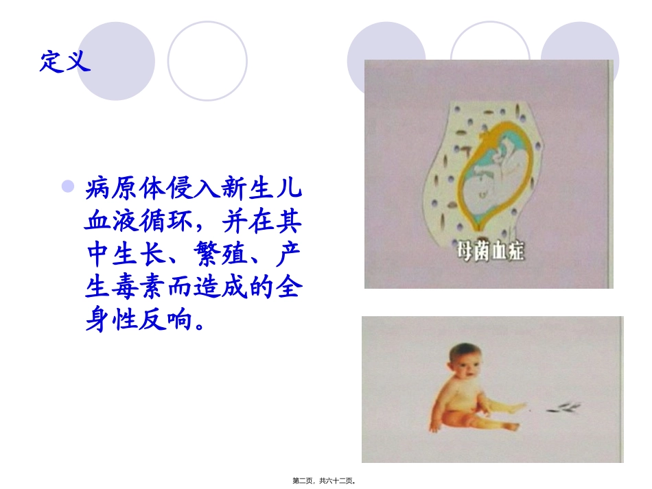 4章3节新生儿败血症详解 医学教学课件_第2页