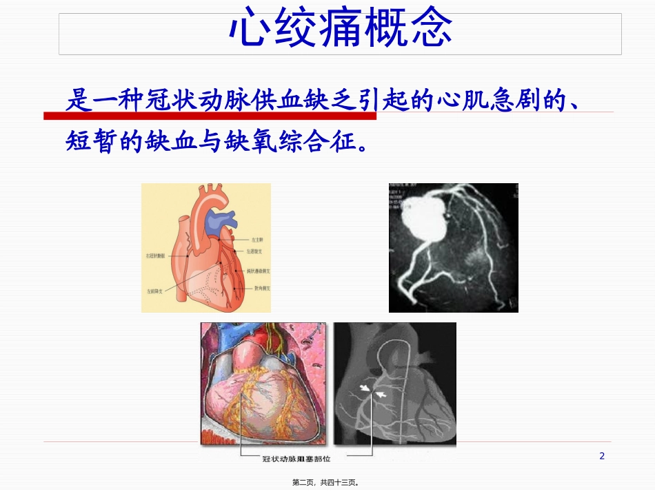26章 抗心绞痛药 医学教学课件_第2页