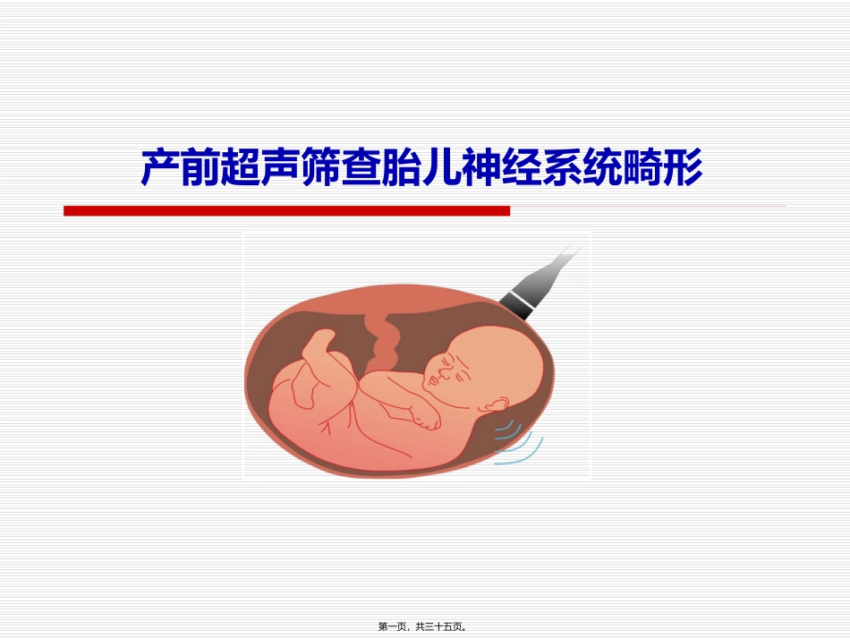 产前超声筛查胎儿神经系统畸形 培训课件_第1页