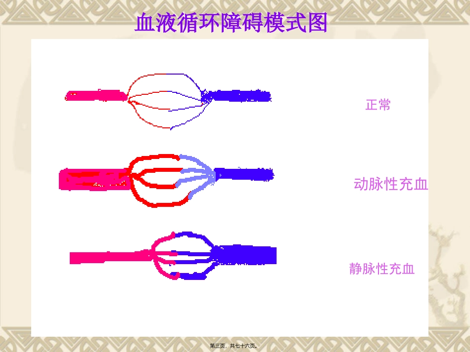 第三章   局部血液循环障碍碍 医学教学课件_第3页