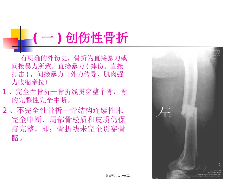 第四章、骨关节损伤 培训课件_第3页