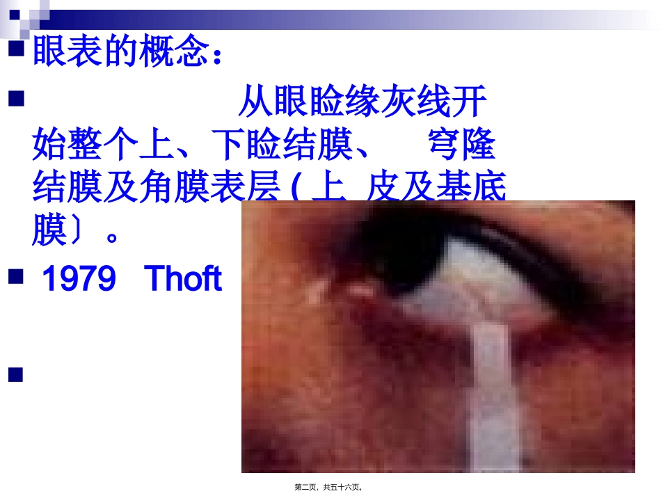 第五章--眼表病医学教学课件_第2页