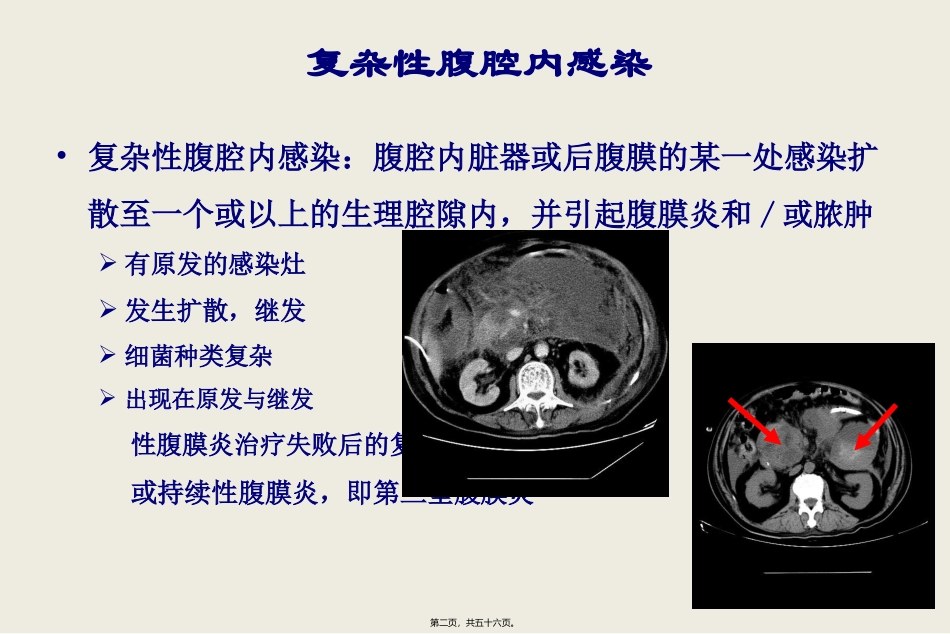 复杂性腹腔感染的处理 医学教学课件_第2页