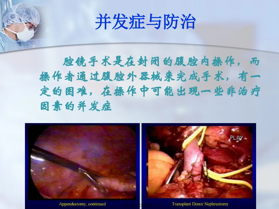 腹腔镜并发症与防治医学培训讲座课件_第2页