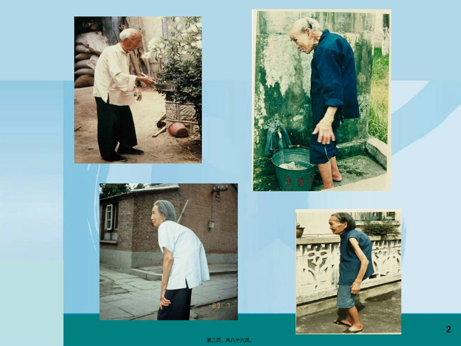 骨质疏松症的诊治进展 医学教学培训课件_第2页