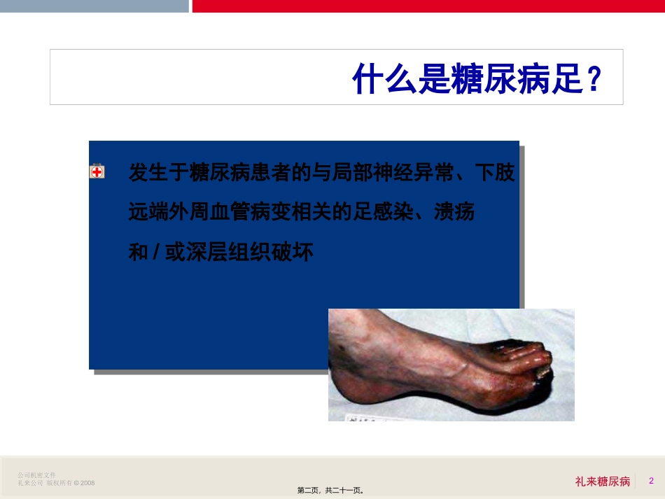 6糖尿病足赵小涛_第2页