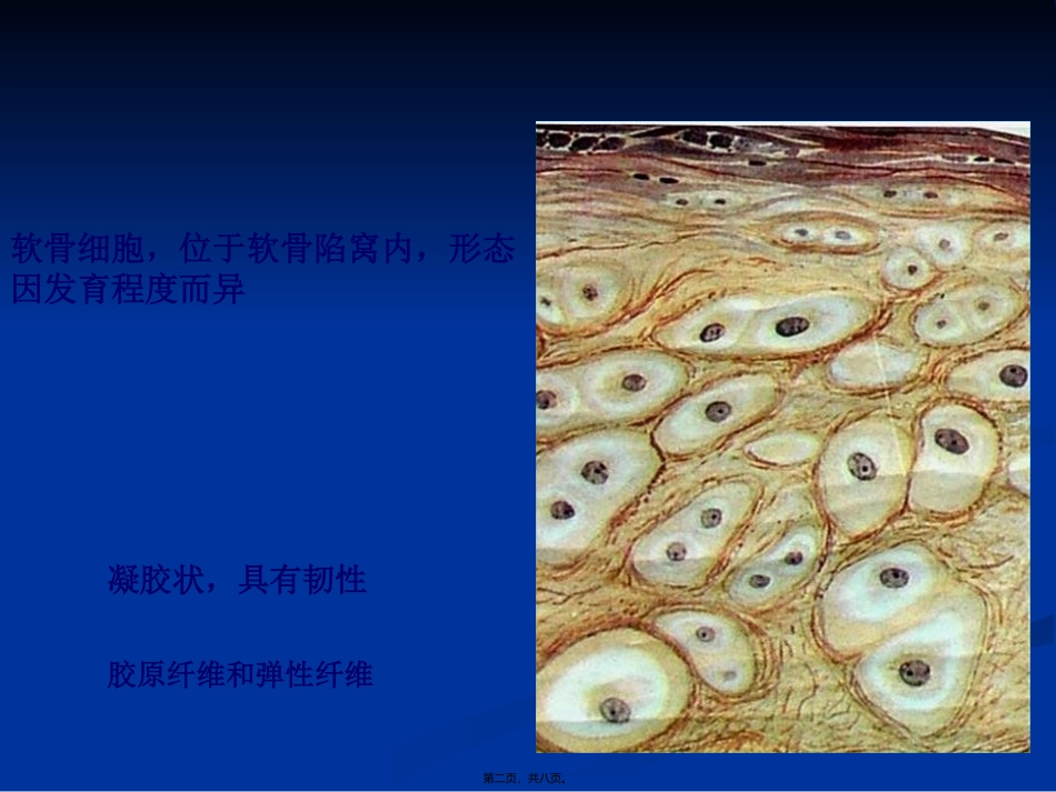 软骨组织和软骨 医学教学课件_第2页