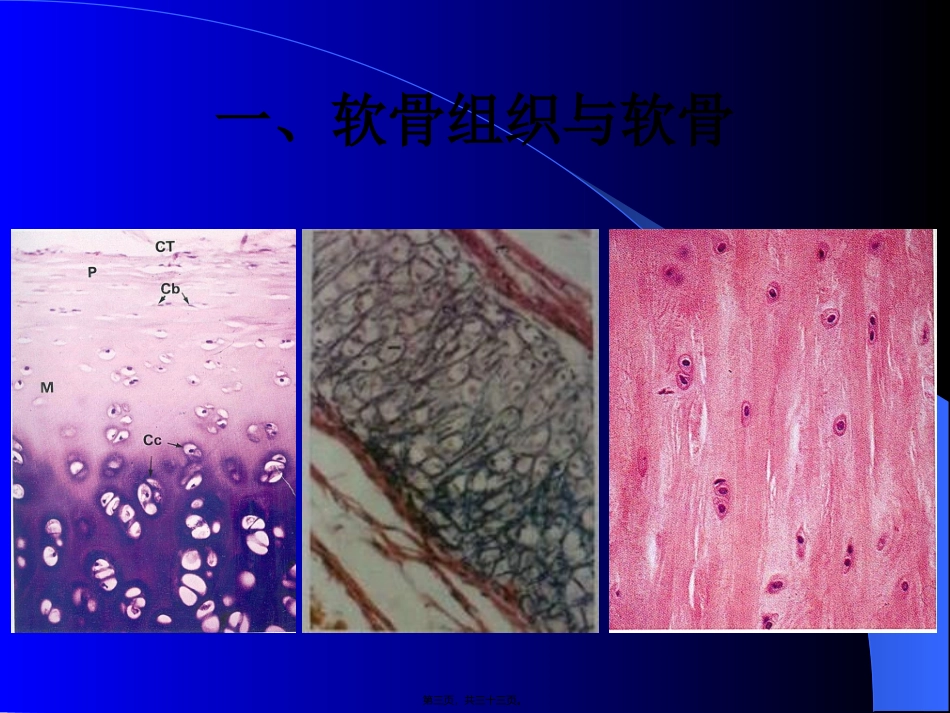 软骨组织与骨组织 讲座课件_第3页
