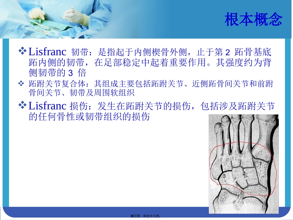 Lisfranc-损伤_第3页