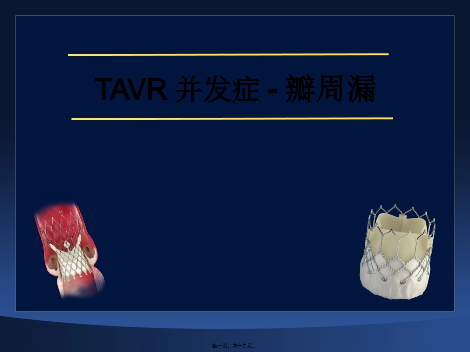 TAVR并发症-瓣周漏_第1页