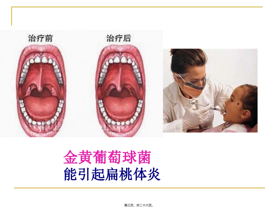 生物教学课件 细菌 教学重点：细菌的形态和结构特征_第3页