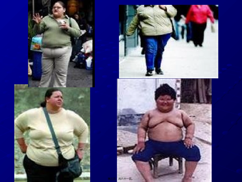 7肥胖与高血压_第3页