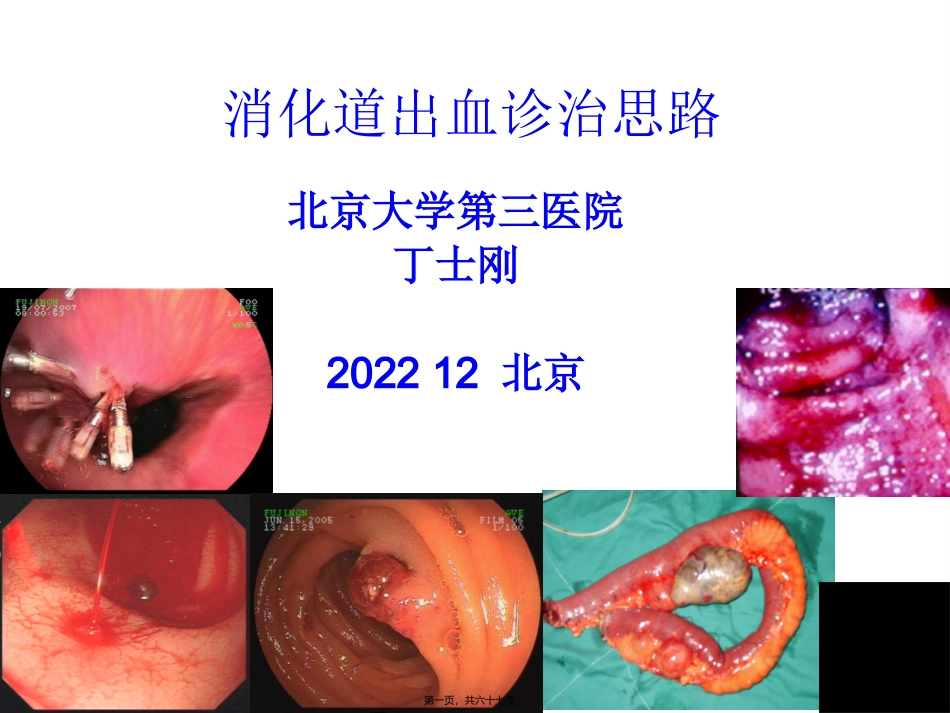 消化道出血诊治思路(消化科培训课件)_第1页