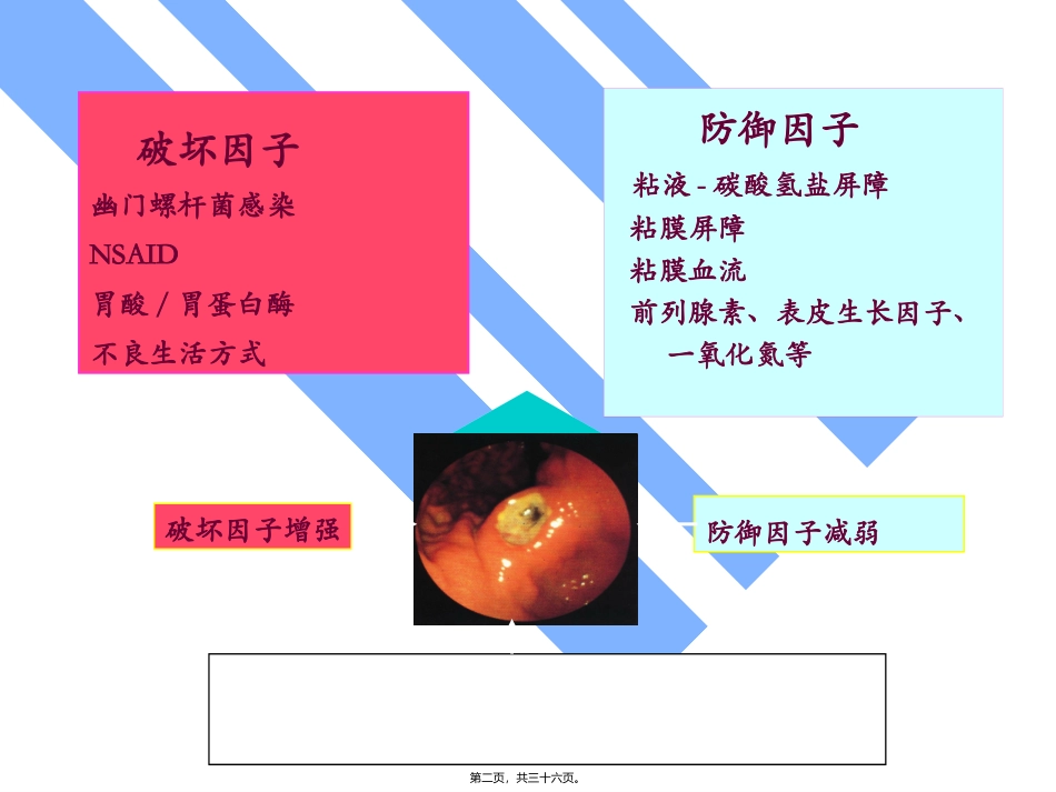 【药健康】浅述胃粘膜防御因子在消化性溃疡中的作用_第2页