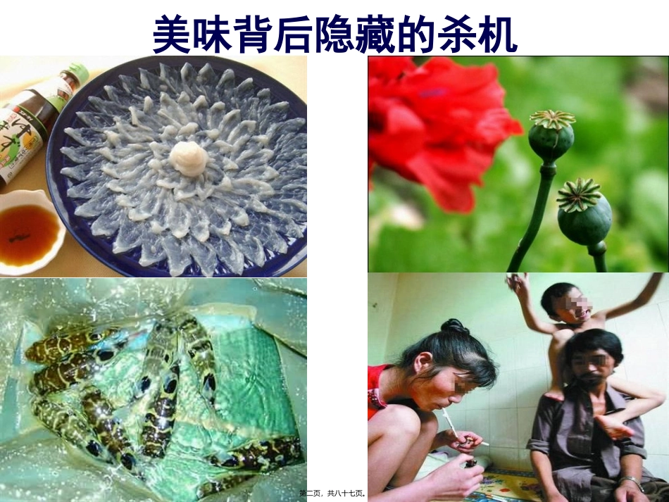 痛风 关节内的结石引发尿酸性肾结石的现代富贵病  医学教学课件_第2页